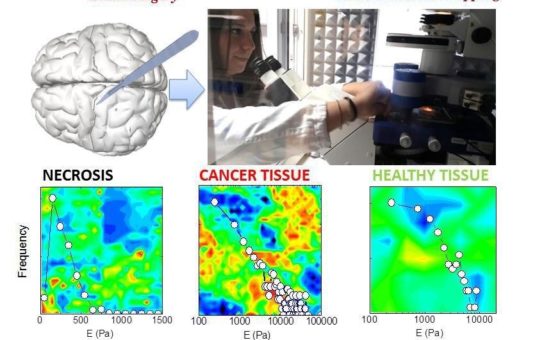 Untersuchungen zur Biomechanik der Zelle mit JPKs NanoWizard®- und CellHesion®-Rasterkraftmikroskopen an der Katholischen Universität Rom