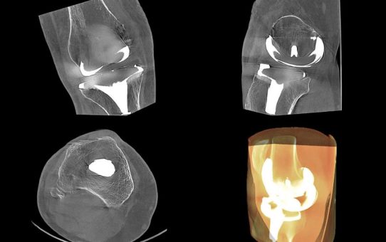 Perspektive DVT – Anwendung der DVT in der Grenzflächenbeurteilung