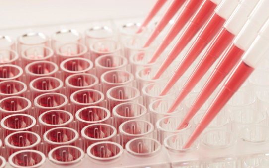 Verlässliche Antikörpertests für die COVID-19 Diagnostik - die beiden Biotechnologieunternehmen CANDOR Bioscience GmbH und trenzyme GmbH leisten mit ihren Produkten einen wichtigen Beitrag für die COVID-19 Test-Entwicklung