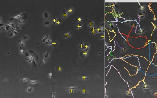 Sparen Sie Zeit: Automatische Analyse von Chemotaxis-Assays