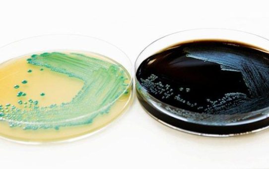 NEU „TentaSpeed L. mono“: Nachweis von Listeria spp. & Listeria monocytogenes in Lebensmitteln in 6h!