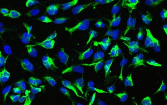 Folgenreicher Fehler: Neurale Stammzellen werden durch epigenetische Reprogrammierung zu Treibern kindlicher Hirntumoren