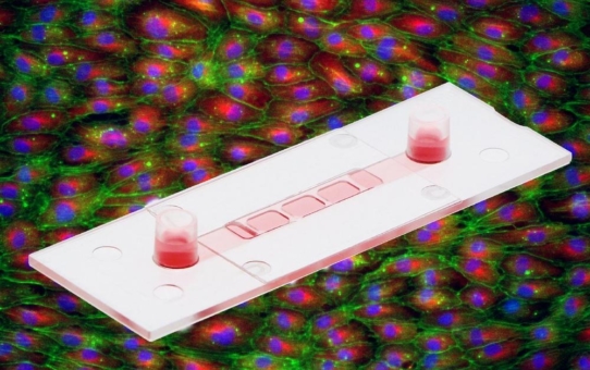 ibidi Produktneuheit: Ein neues µ-Slide für 3D-Zellkultur unter Fluss