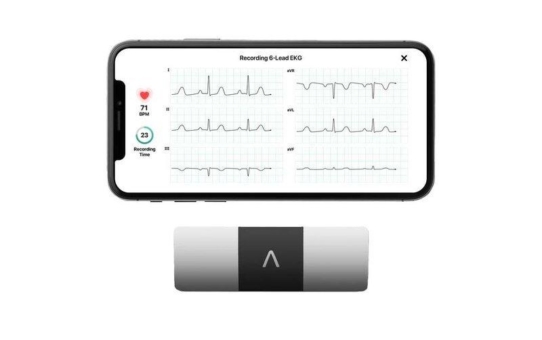 AliveCor KardiaMobile 6L - Einmaliges Angebotspaket für die Patientenüberwachung aus der Ferne