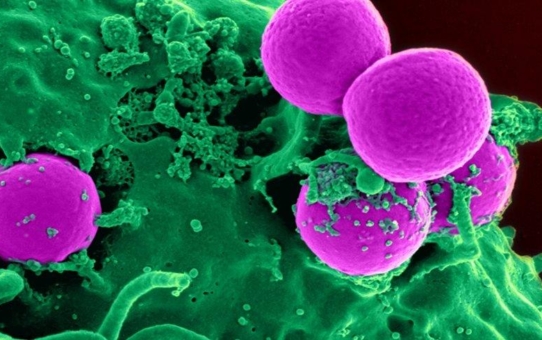 Gefährliche Bakterien mit Nanopartikeln auflösen
