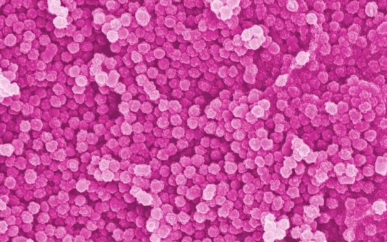 Nanoplastik - ein unterschätztes Problem?