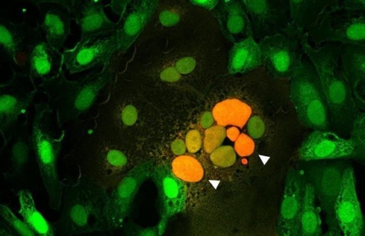 Messen, was verbindet - Gewebeschäden durch Zellfusion in COVID-19 und die Rolle des Spikeproteins