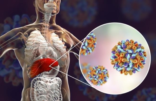 Biomarker identifiziert, der klinischen Verlauf einer Hepatitis-B-Infektion vorhersagen könnte