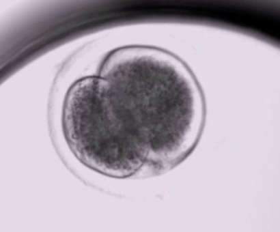 Embryonalentwicklung in Zeitlupe