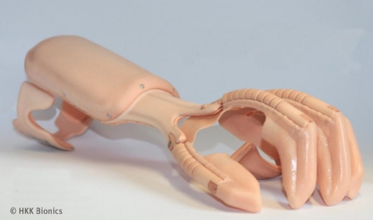 Ein leistungsfähiger Lithium-Ionen-Akku für eine Hand-Orthese von HKK Bionics