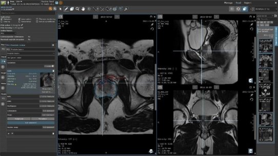 KI-Software vom Hamburger Start-up FUSE-AI hat Premiere auf der RSNA in Chicago