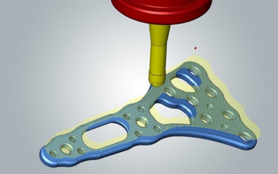 OptimierteWerkzeugbahnen für medizintechnischeBauteile