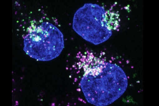 Neu identifiziertes Protein ermöglicht Krebszellen, auf alternative Nahrungsquellen auszuweichen