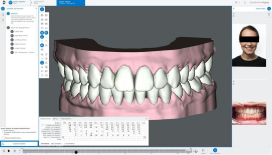 Dentsply Sirona präsentiert Upgrades der SureSmile® Aligner-Software für ein besseres Benutzererlebnis