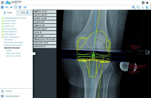 mediCAD® Web – die Planungssoftware der Zukunft ist online!