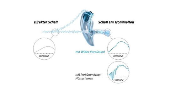 Optimale Klangqualität durch Ultraschnelle Signalverarbeitung: Die neue Hörsystem-Plattform Widex Moment