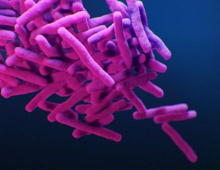 Tuberkulose: Die diagnostische Lücke schließen