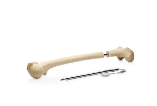 Smarter limb lengthening mit den FITBONE® -Systemen