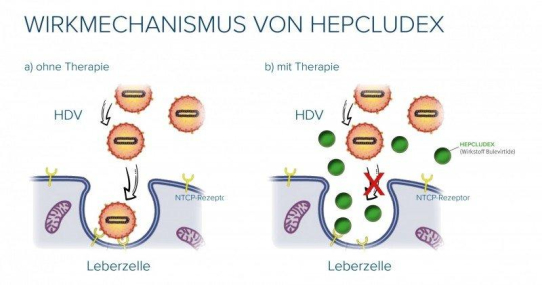 Erstes Medikament gegen Hepatitis D von der Europäischen Kommission zugelassen