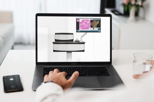 Schnelle intraoperative Auswertung frischer zytologischer Biopsien mit der VivaScope 2500 Technologie