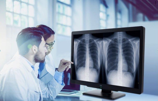 Displays von der Radiologie bis zur Fernbefundung