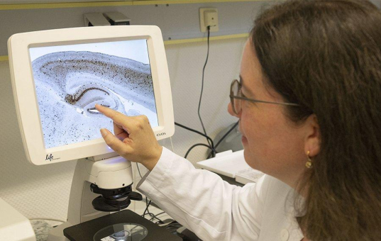 Hochschule Kaiserslautern erforscht Wirkung von Cannabinoiden auf das Darmnervensystem