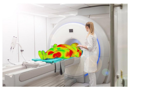 MRT trotz Implantat – Simulation schützt vor Hitzeschäden