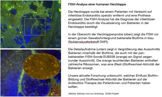 Erfolgreicher Abschluss des Forschungsprojekts TEAM